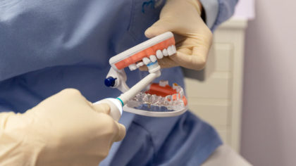 Vuoi prenderti cura della tua bocca? Con una pulizia dentale professionale previeni le patologie dentali.