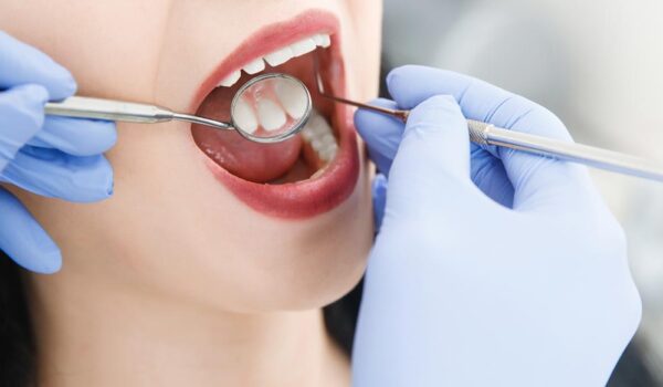 otturazione estetica otturazione estetica