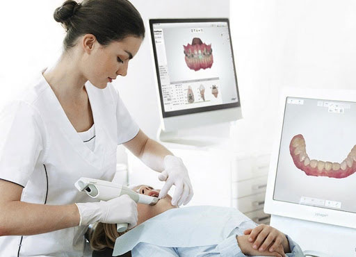 telecamera intraorale telecamera intraorale