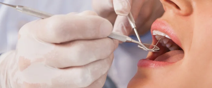prevenzione dentale