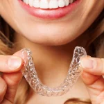 apparecchio denti invisibile