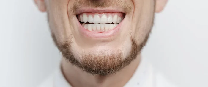 bruxismo