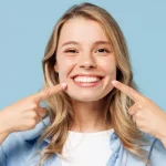 sbiancamento dentale milano